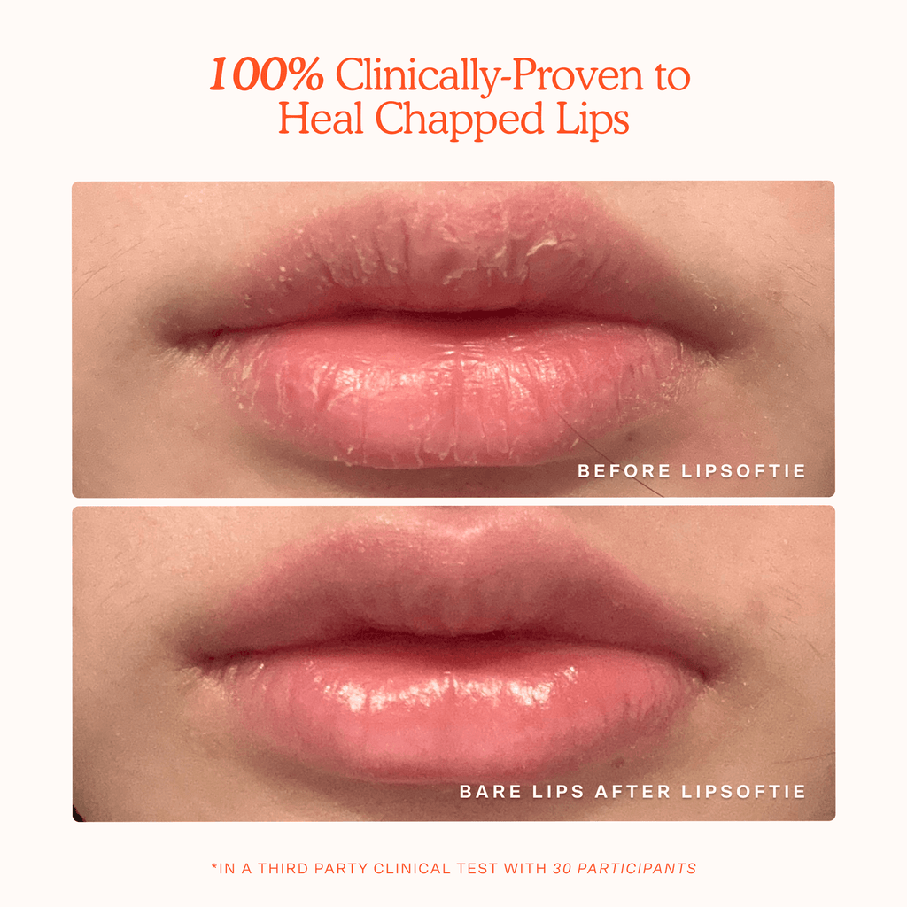 LipSoftie™ Lip Treatment Trio