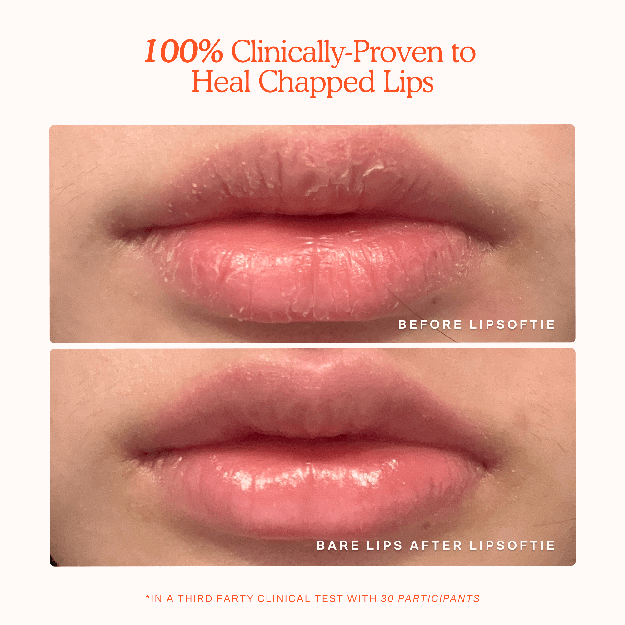 LipSoftie™ Lip Treatment Trio