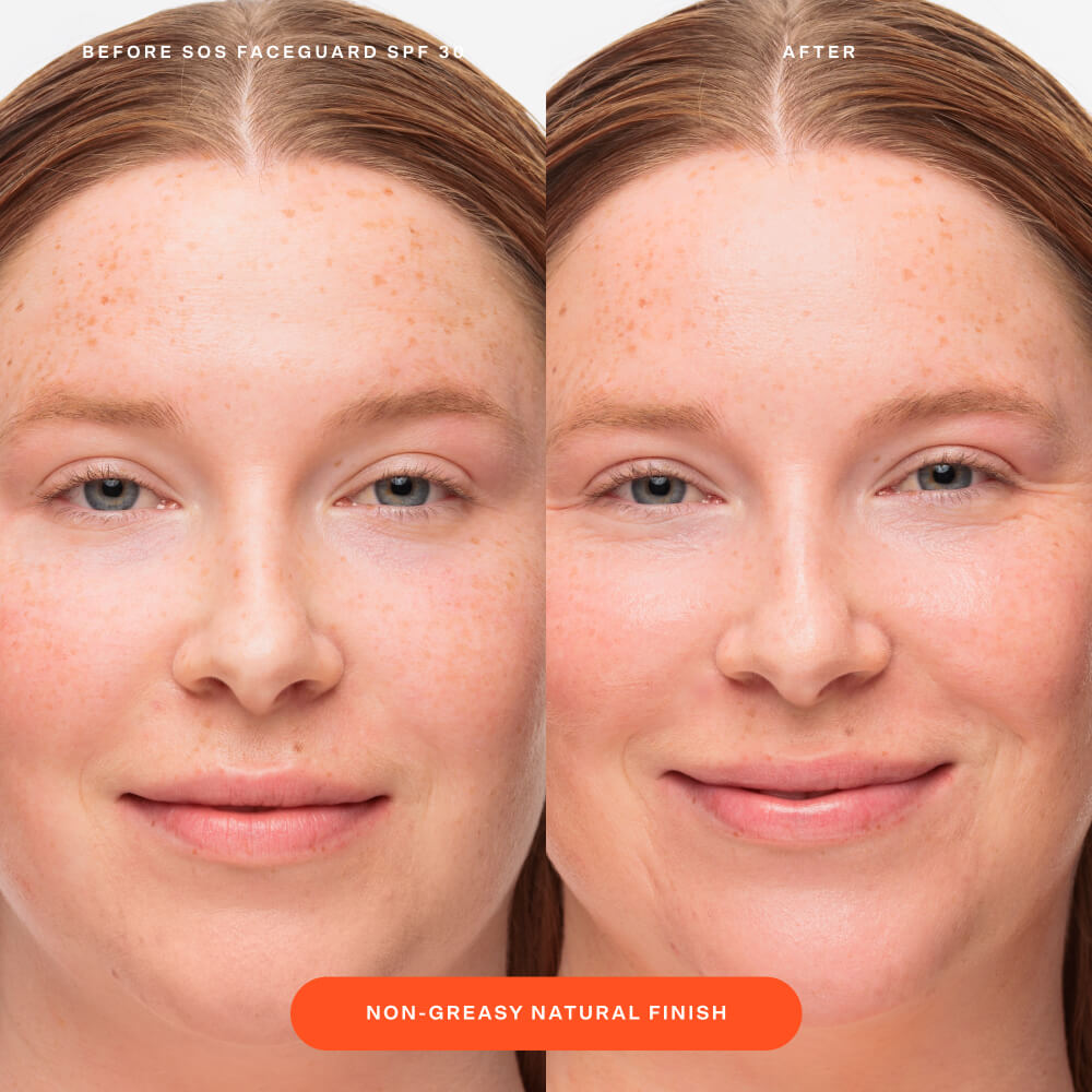 SOS FaceGuard™ SPF 30 Sunscreen PA+++